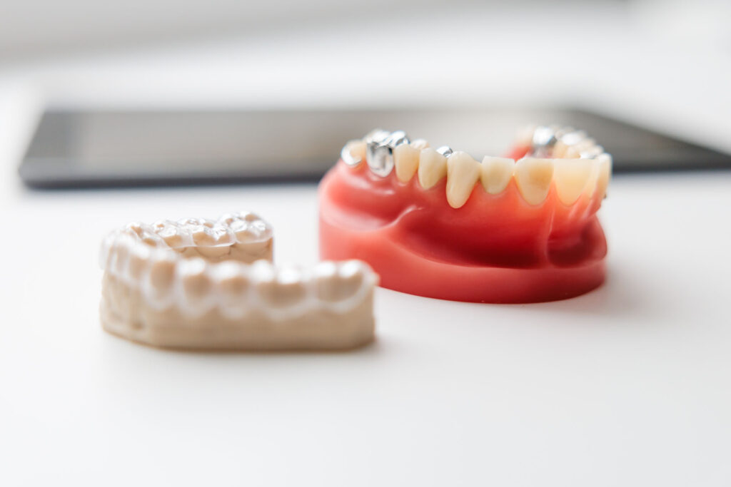 Knirscherschienen | Zahnmedizin Nieder Olm